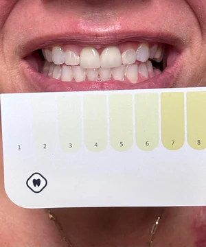 Customer using Dr.Dent