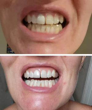 Customer using Dr.Dent